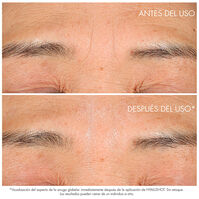 CAPTURE TOTALE HYALUSHOT  15ml-217555 CAPTURE TOTALE HYALUSHOT  15ml-217555 3